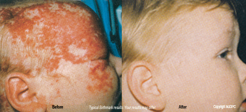 aesthetic_laser_treatments1