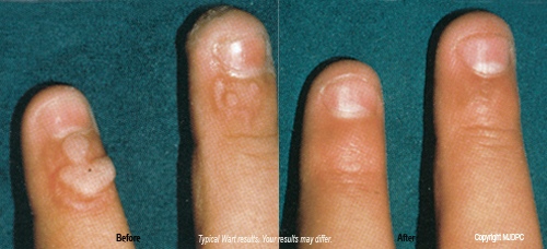 aesthetic_laser_treatments2